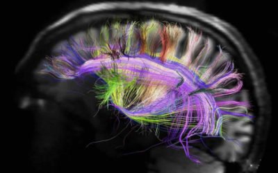 How the Brain Rewires Itself
