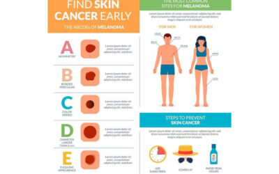 The Importance of Early Skin Cancer Detection