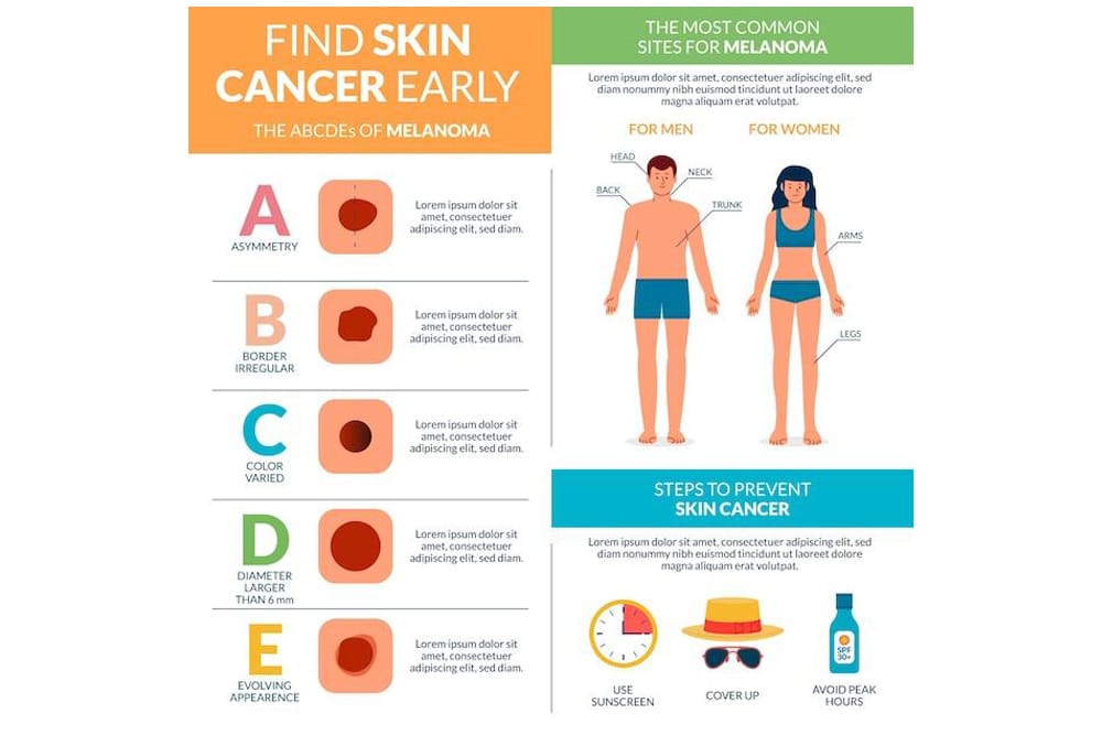 Skin Cancer
